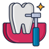 Root Canal Treatment